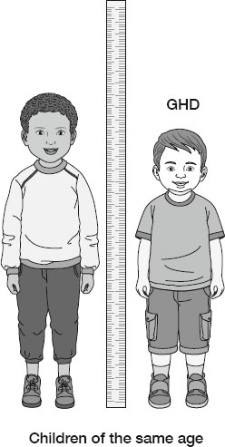 Illustration comparing two children of the same age standing beside a height scale; the child on the left is taller, while the child on the right labeled GHD (growth hormone deficiency) is shorter, highlighting growth difference.