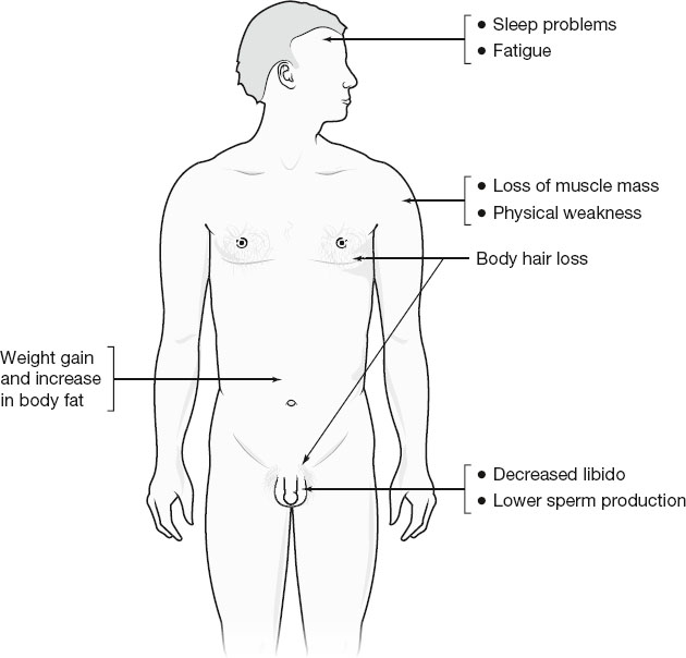 Diagram of a male body showing symptoms of low testosterone: sleep problems, fatigue, loss of muscle mass, physical weakness, body hair loss, weight gain, decreased libido, and reduced sperm production.
